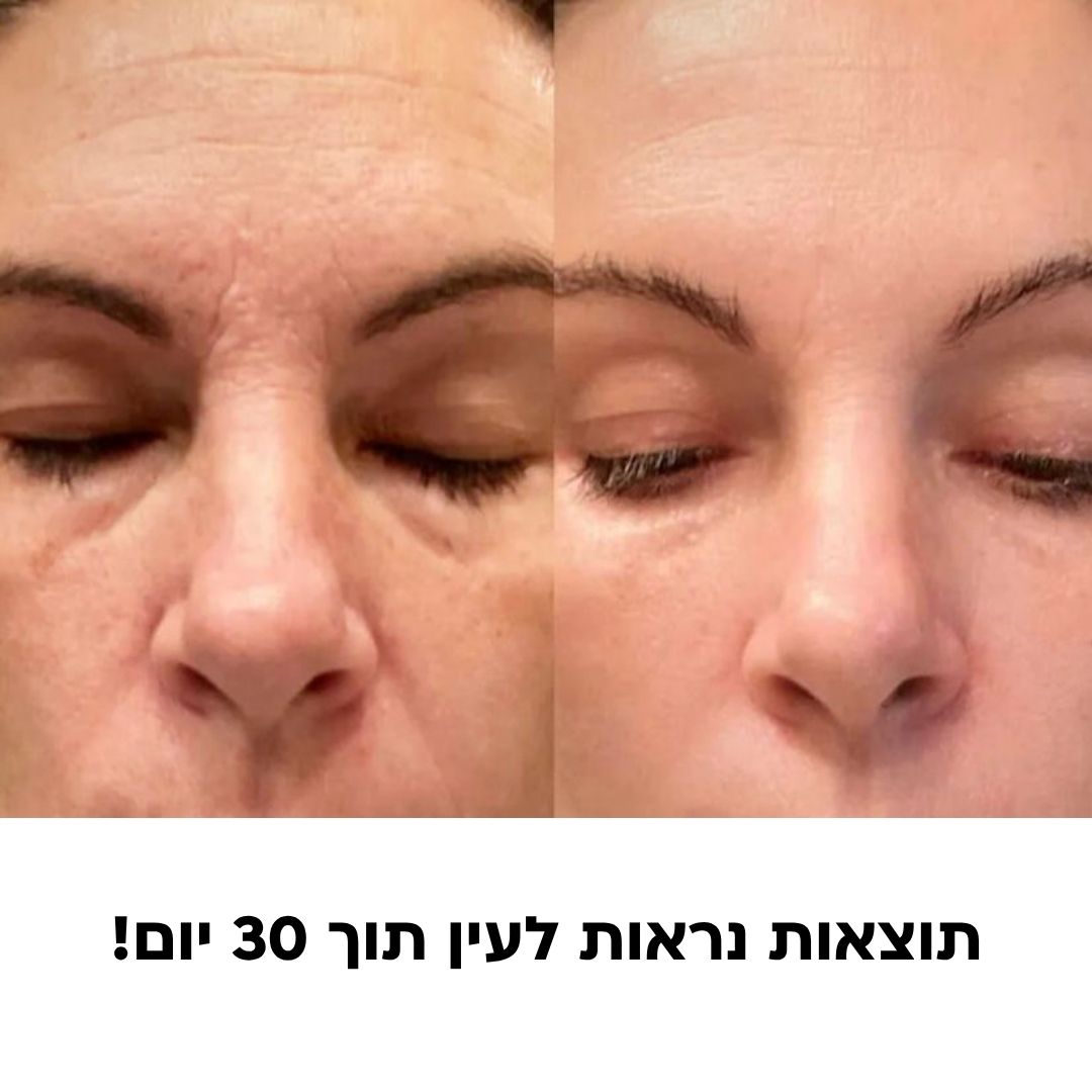 Lanure - המכשיר החכם למיצוק ועור זוהר